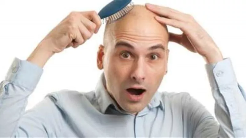 صدق او لا تصدق ...تلوث الهواء يسبب الصلع لدى الرجال