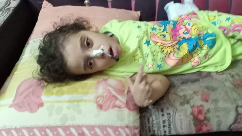 حالة فريدة من نوعها.. «رودي» أصيبت بتشنجات وفقدت النطق وعجز الأطباء عن علاجها