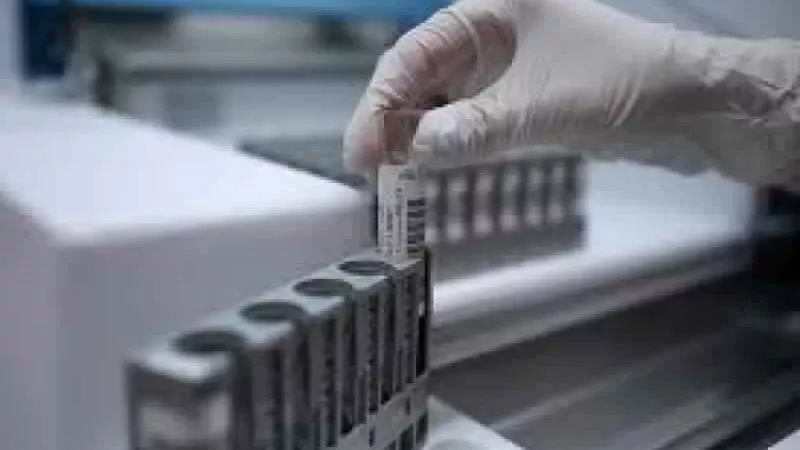 تعذيب قرود وكلاب داخل مختبر للسموم بألمانيا..صور