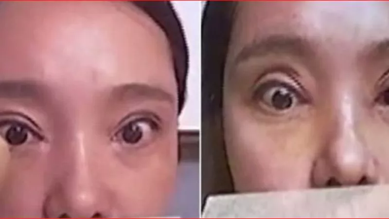انفقت مايقارب من 200 دولار فى جراحة تجميلية انتهت بالندم