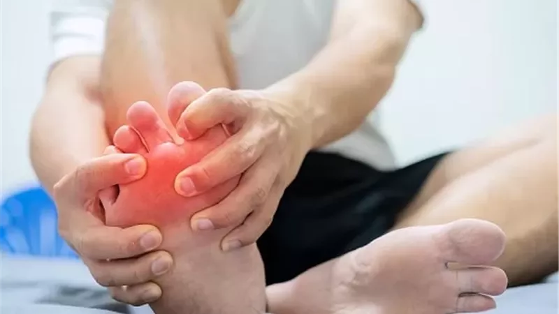 طرق طبيعية لتخفيف آلام النقرس بدون أدوية