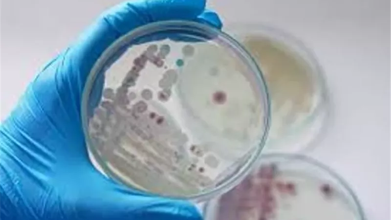 ابتكار طبي يكشف العدوى البكتيرية في دقائق