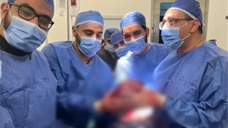استئصال ورم وزنه 8 كجم من كلية مريض بمستشفى 30 يونيو بالإسماعيلية