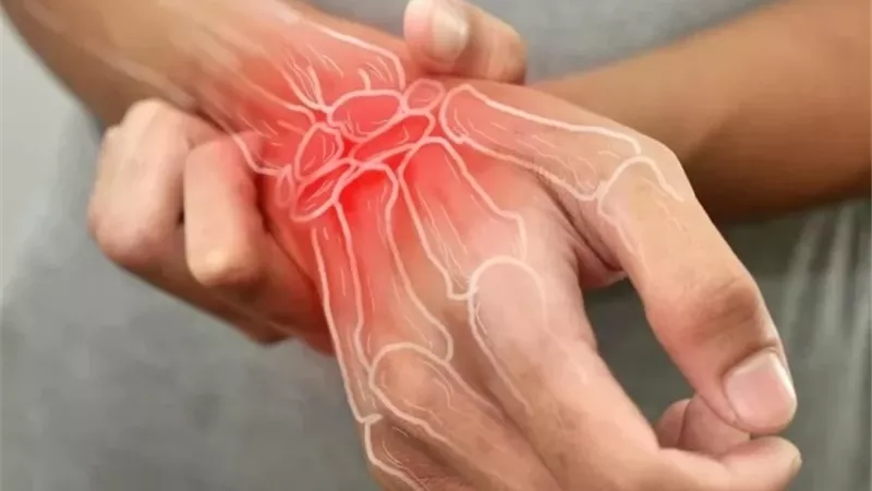 ببتيد طبيعي يفتح آفاقًا لعلاج أكثر أمانًا لالتهاب المفاصل