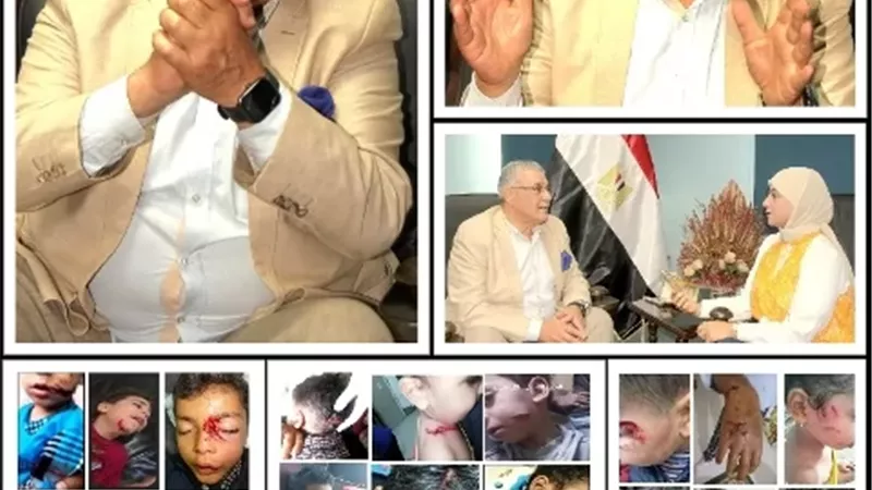 اللواء مدحت الحريشى لـ«بوابة الجمهورية»: الكلاب الضالة قنابل بيولوجية موقوتة