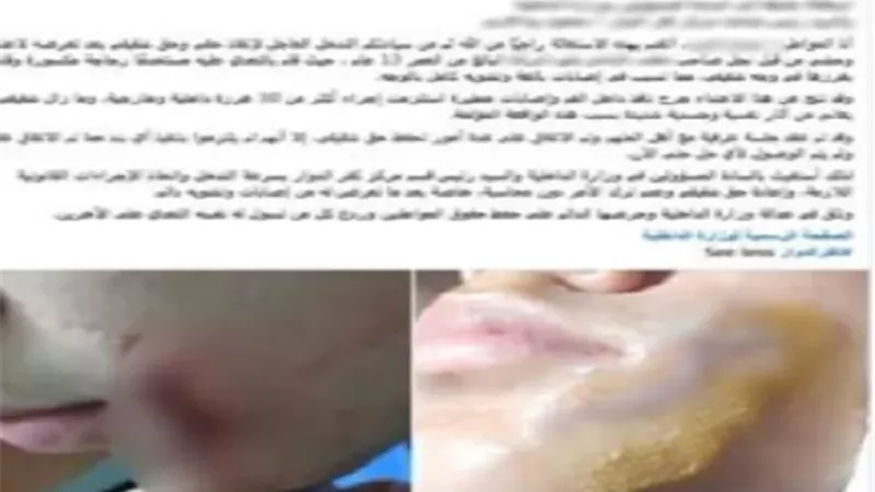 ضبط طالب اعتدى على زميله بـ