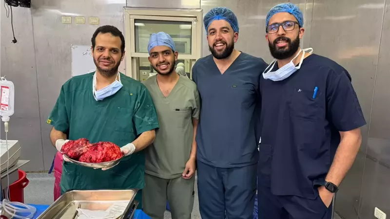 فريق طبي بقصر العيني ينجح في استئصال ورم نادر من صدر مريض ستيني