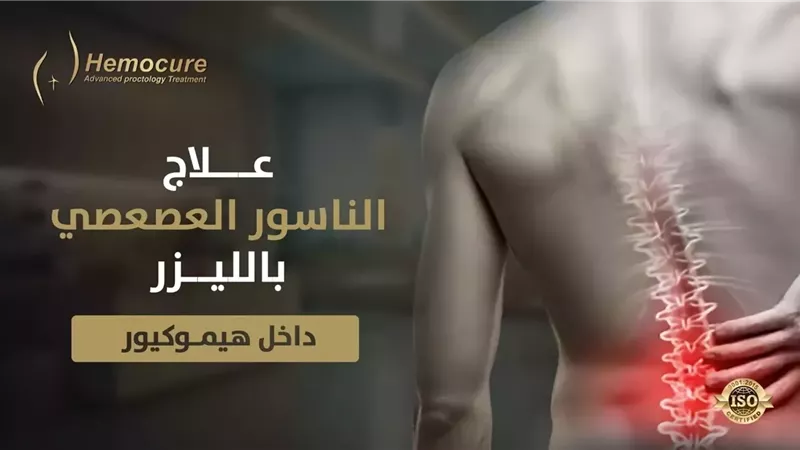 علاج أمراض الشرج بالليزر: دليل شامل عن الناسور الشرجي والناسور العصعصي