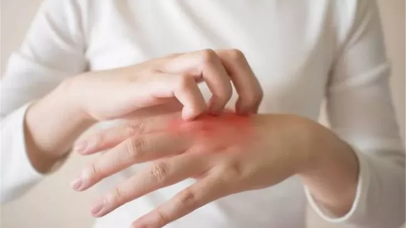 خبراء يوضحون أحدث طرق علاج الحساسية وتقليل نوباتها