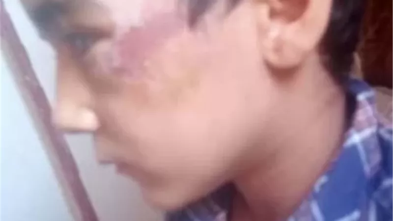 استغاثة أم