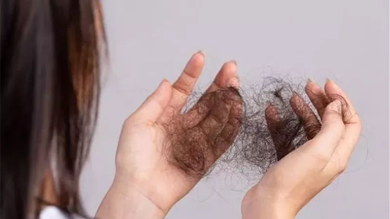 تساقط الشعر .. الأسباب الشائعة وأفضل الطرق الطبيعية للحد منه
