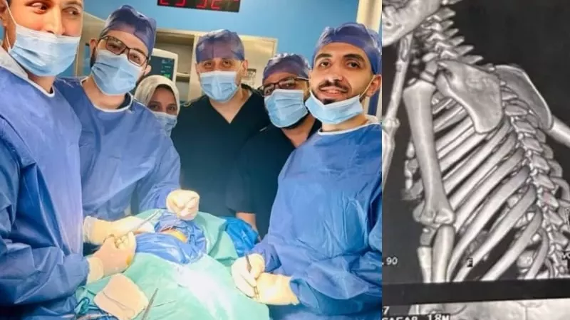 إنقاذ طفل من الموت بمعجزة داخل مستشفيات جامعة بنها بعد اختراق مفك لرقبته