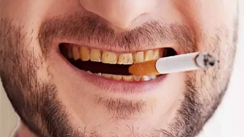 من القهوة إلى التدخين .. عادات يومية تسرق بياض أسنانك