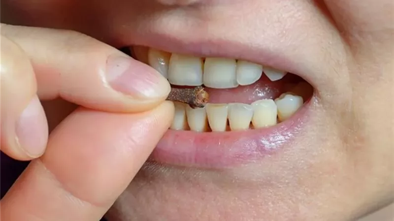 فوائد القرنفل للأسنان.. مضاد للالتهاب ومسكن ومقاوم للبكتيريا