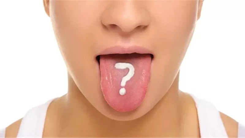 علامات صامتة على اللسان قد تكشف سرطان الفم في مراحله الأولى