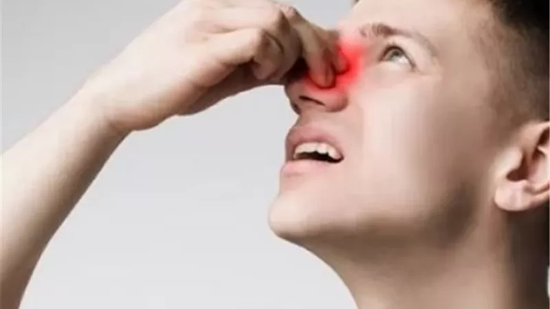 نزيف الأنف .. ماذا تفعل عند حدوثه وكيف تتجنبه؟