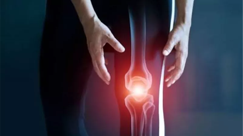 دراسة .. تناول الكحول يرتبط بارتفاع خطر الإصابة بالفصال العظمي