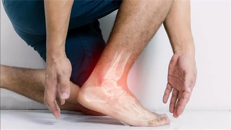 علامات تظهر في الساقين قد تنذر بارتفاع الكوليسترول وتضيق الشرايين