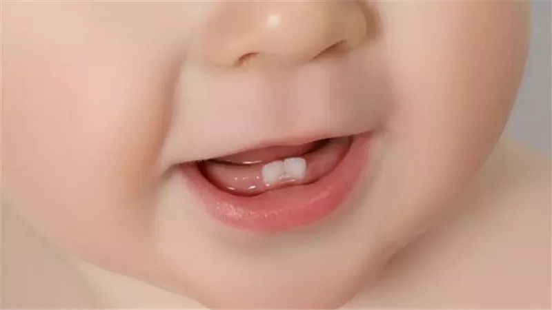 تسنين الطفل