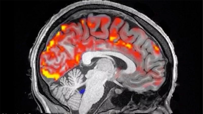 مفاجأة.. سائل منظف يغسل الدماغ أثناء النوم