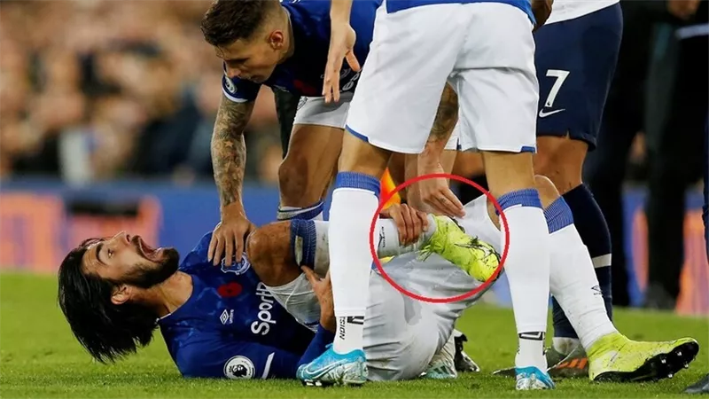 تطورات خطيرة فى إصابة جوميز لاعب إيفرتون