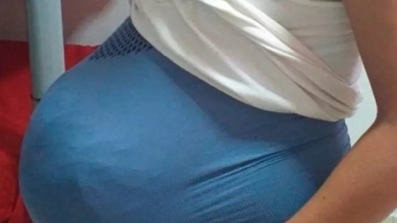 ضبط سيدة ادعت الحمل لتهريب ١٥ قطعة حشيش