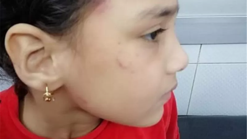 أم الطفلة جنة الجديدة : كويتها بالنار لنقلها أخباري لأهل زوجي المحبوس..صور