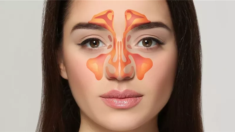 من بينها التدخين والزوائد اللحمية ... 10 أسباب لالتهاب الجيوب الأنفية