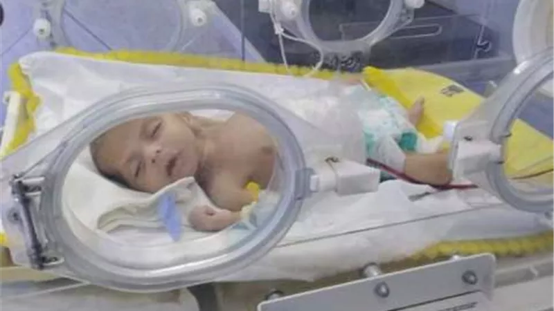 عملية جراحية لطفل عمره 53 يوما بدار إيواء كفرصقر..صور