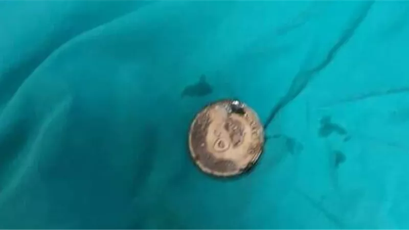 إنقاذ 3 أطفال بمستشفى الأقصر الدولى بعد إبتلاعهم عملات معدنية