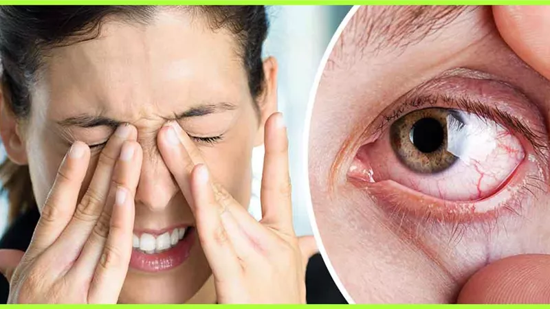علامات جفاف العين وأسبابها