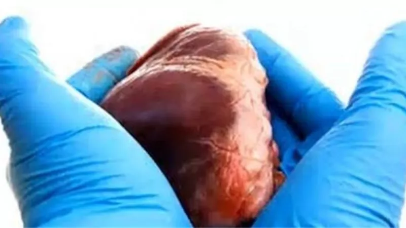 إختراق طبى.. تعيد النبض لقلوب الموتى