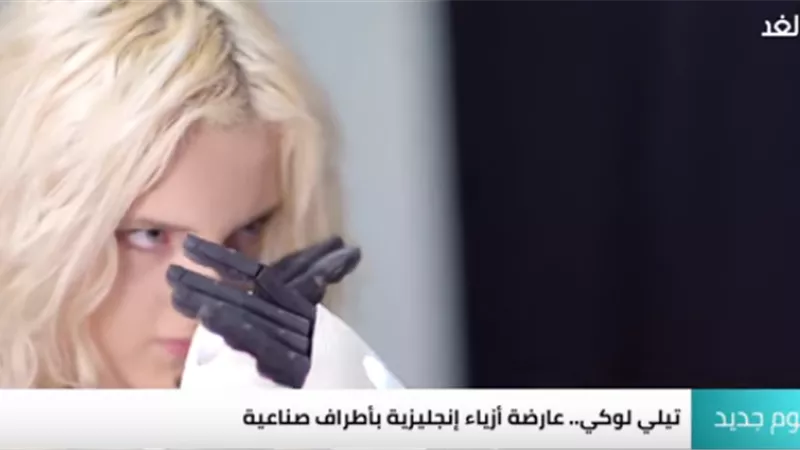 عارضة أزياء بذراعين صناعيين إلكترونيين