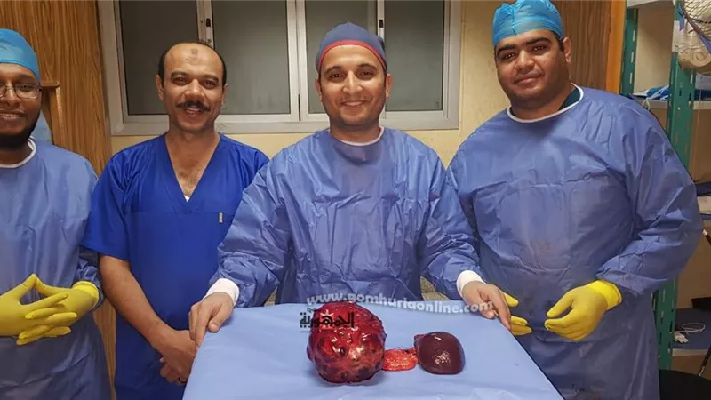 جامعة أسيوط تنجح في إنقاذ حياة طفلة من البحر الأحمر باستئصال ورم ضخم ونادر بالبنكرياس يزن 10كجم