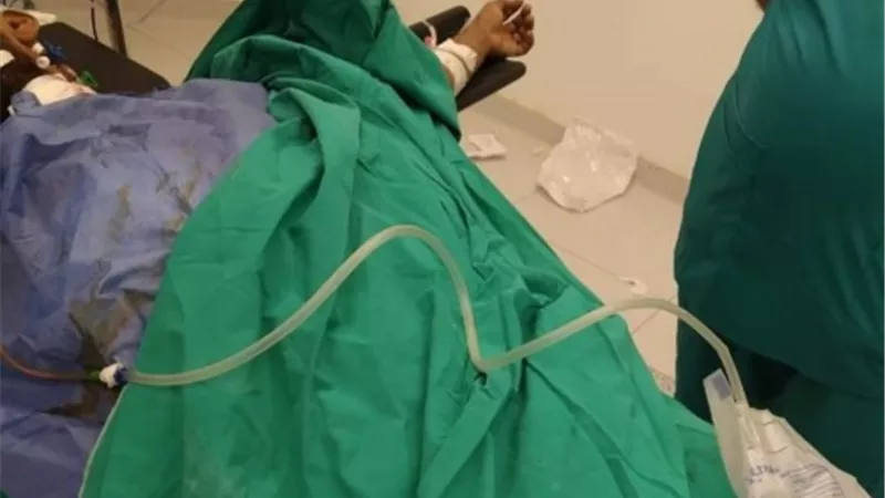 إنقاذ شاب من الموت إثر إصابته بتهتك بالطحال بمستشفى إسنا