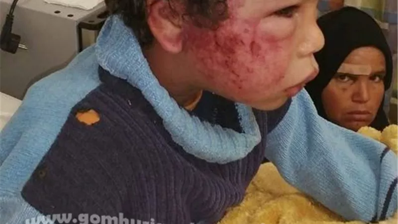 قسوة أب . إنهال على نجلته بكابل كهرباء وادعى اصابتها في حادث بالإسماعيلية.صور