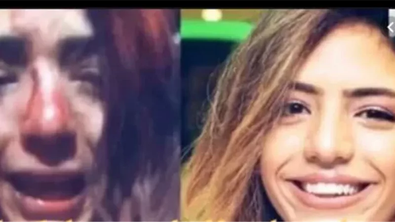 هشم وجهها .. شاب مجهول يعتدي على مطربة شهيرة .. صور