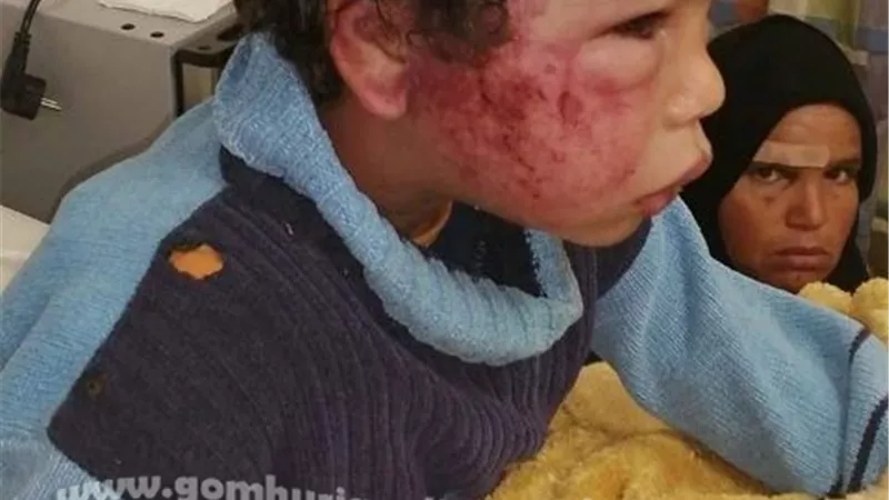 ضحية تعذيب والدها في الإسماعيلية تفاؤل ومتابعة تنفيذية .فيديو