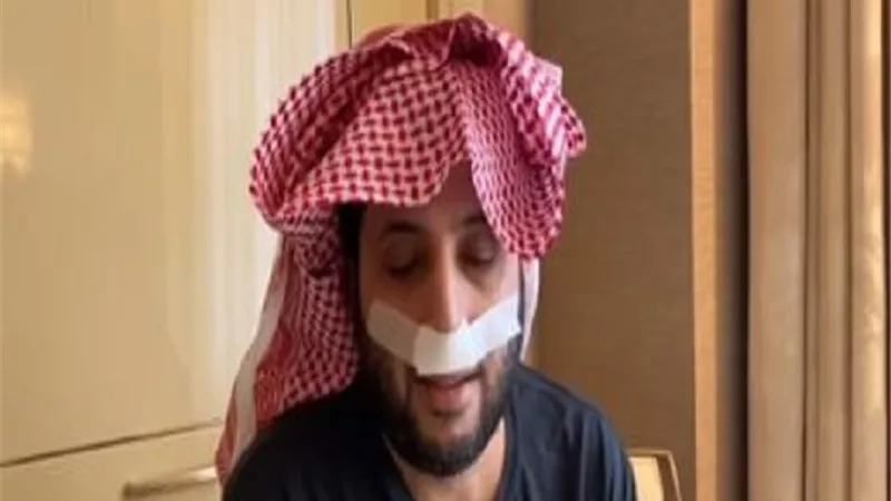 أصالة ورابح صقر يوجهان رسالة للمستشار تركى آل الشيخ