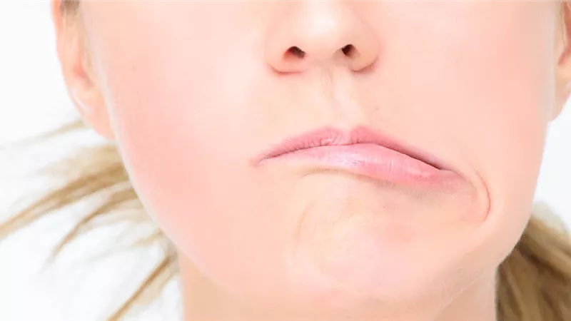 5 أسباب للإصابة بالعصب السابع..تعرف عليها