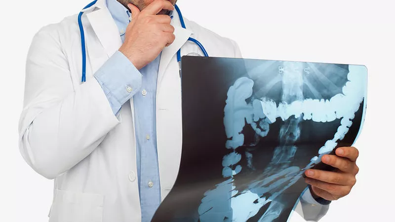 نصائح للوقاية من سرطان القولون