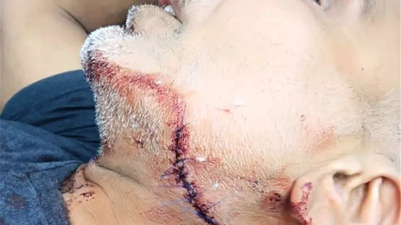 تاجر مخدرات وكلبه يشرعان فى قتل موظف ونجلة ب60 غرزة فى المعصرة بالصور