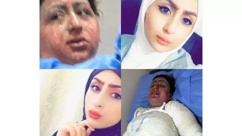 شاهد ... تشعل النار في نفسها أمام زوجها دون اكتراث او محاولة لنجدتها