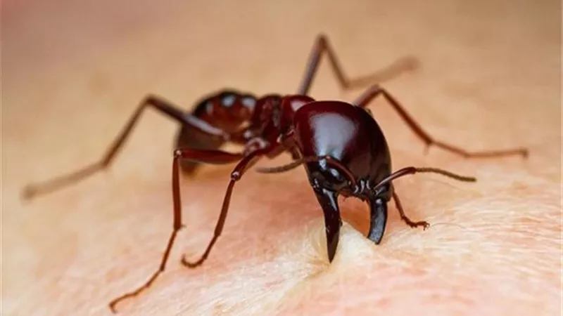 علاج منزلي وسريع للدغة النمل