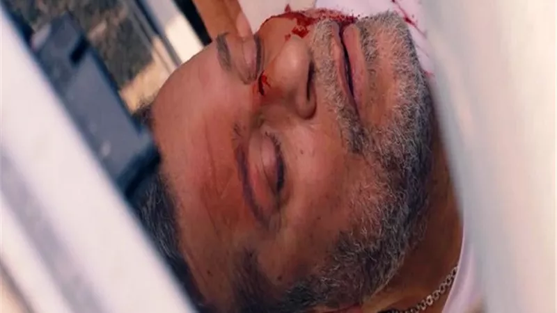 شريف منير يفقد الذاكرة بعد الحادث المروع فى الحلقة 20 من 