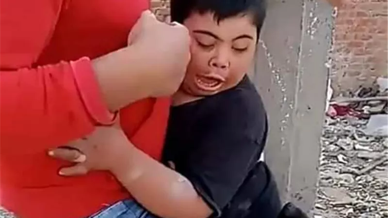 كشفه فيس بوك ..ضبط المتهمين بترويع طفل معاق بكلب بوليسي