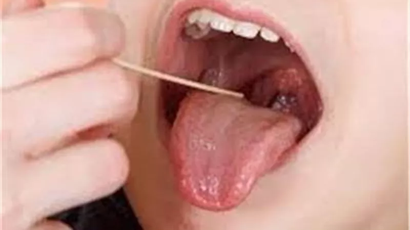 بـ 7 طرق مختلفة .. علاج منزلي لالتهاب الحلق الشديد