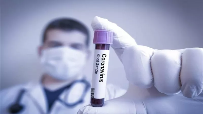 شركة بريطانية تبدأ إنتاج لقاح كورونا.. وطرحه في هذا الموعد