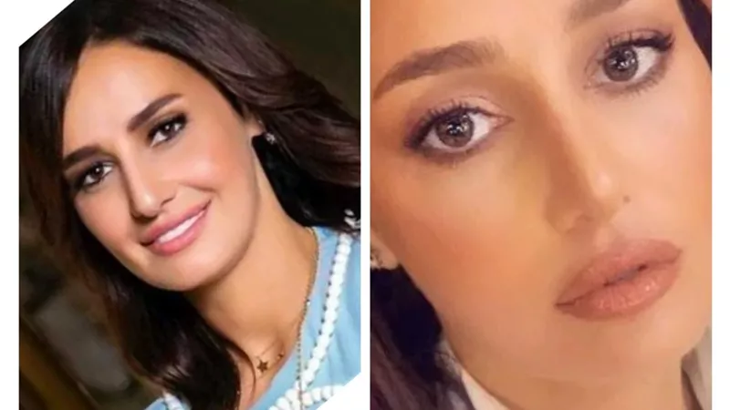 مراحل تغير ملامح حلا شيحة من الأجمل لـ الأسوأ