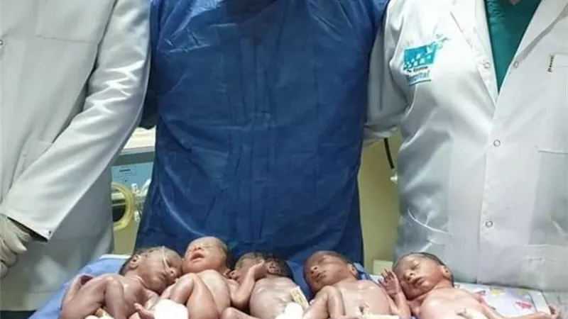سيدة فى العقد الثالث تنجب خمسة توأم بصحة جيدة فى الغردقة .. صور